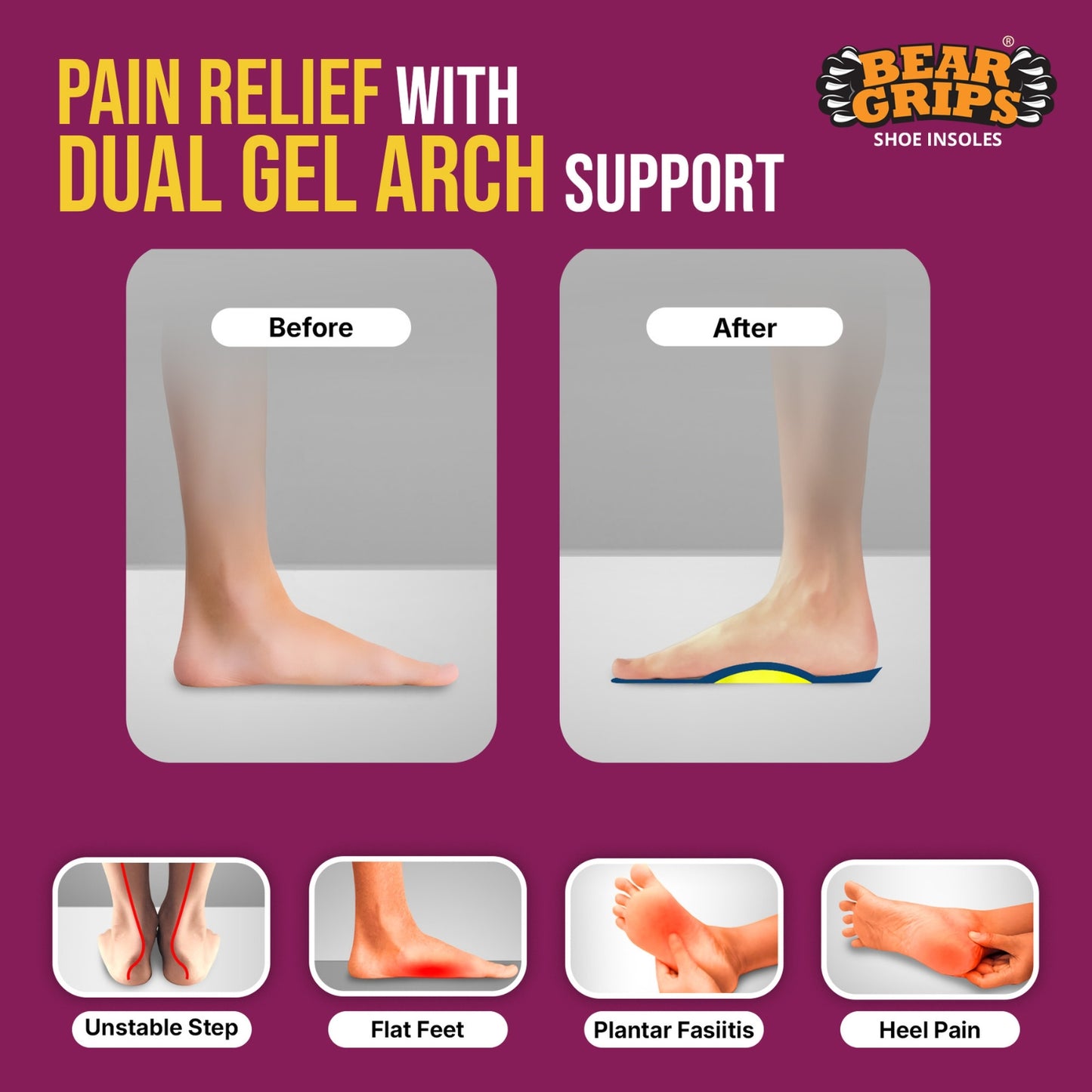 BEAR GRIPS Orthotic Shoe Insoles for Flat Feet, High Arches & Plantar Fasciitis – Dual Gel Arch Support for Pain Relief – Arch+ Insoles | Men & Women| UK Size 9 to 12